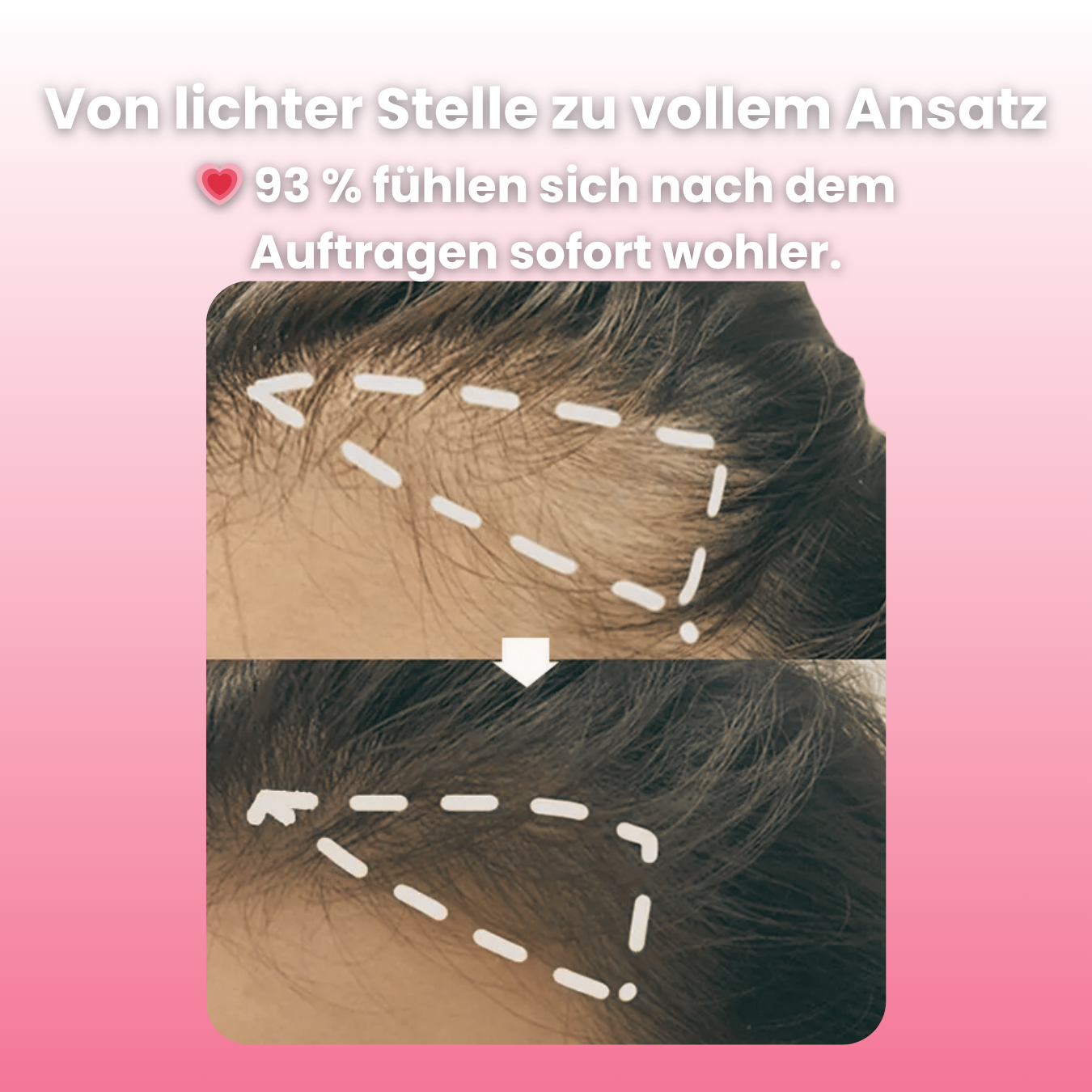 FüllFix™ für Frauen